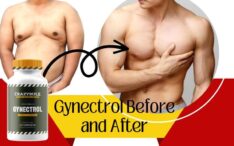 Gynectrol before and after