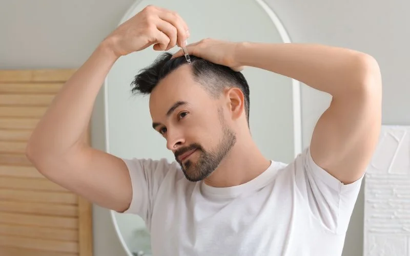 how to use minoxidil for frontal baldness