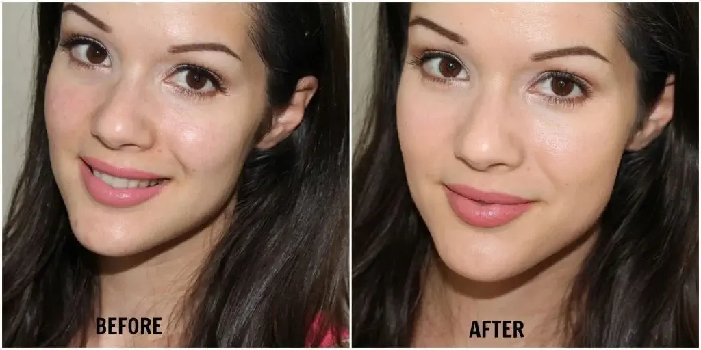 xyz smart collagen cream before and after